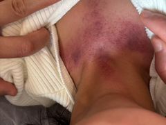 -承启堂中医馆·推拿·针灸(成华馆)
