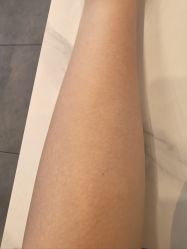 -郑州米兰柏羽集美医疗美容医院
