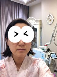 体验前-北京米扬丽格医疗美容·联合丽格鼻整形中心