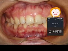 -同步齿科·数字化正畸种植口腔中心(珠海店)