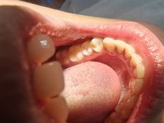 -土豆口腔(凤凰北总店)