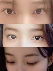-天津健丽·去眼袋医疗美容机构