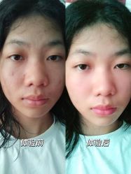 -深圳艺星医疗美容医院