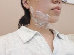 -杭州米兰柏羽医疗美容医院