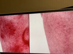 -韩国淼美颜皮肤管理官方直营店