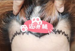 -大麦微针植发全国连锁