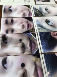 -痣斑堂·取大痣