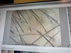 -史云逊养发护发