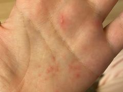 -杭州市第一人民医院(湖滨院区)