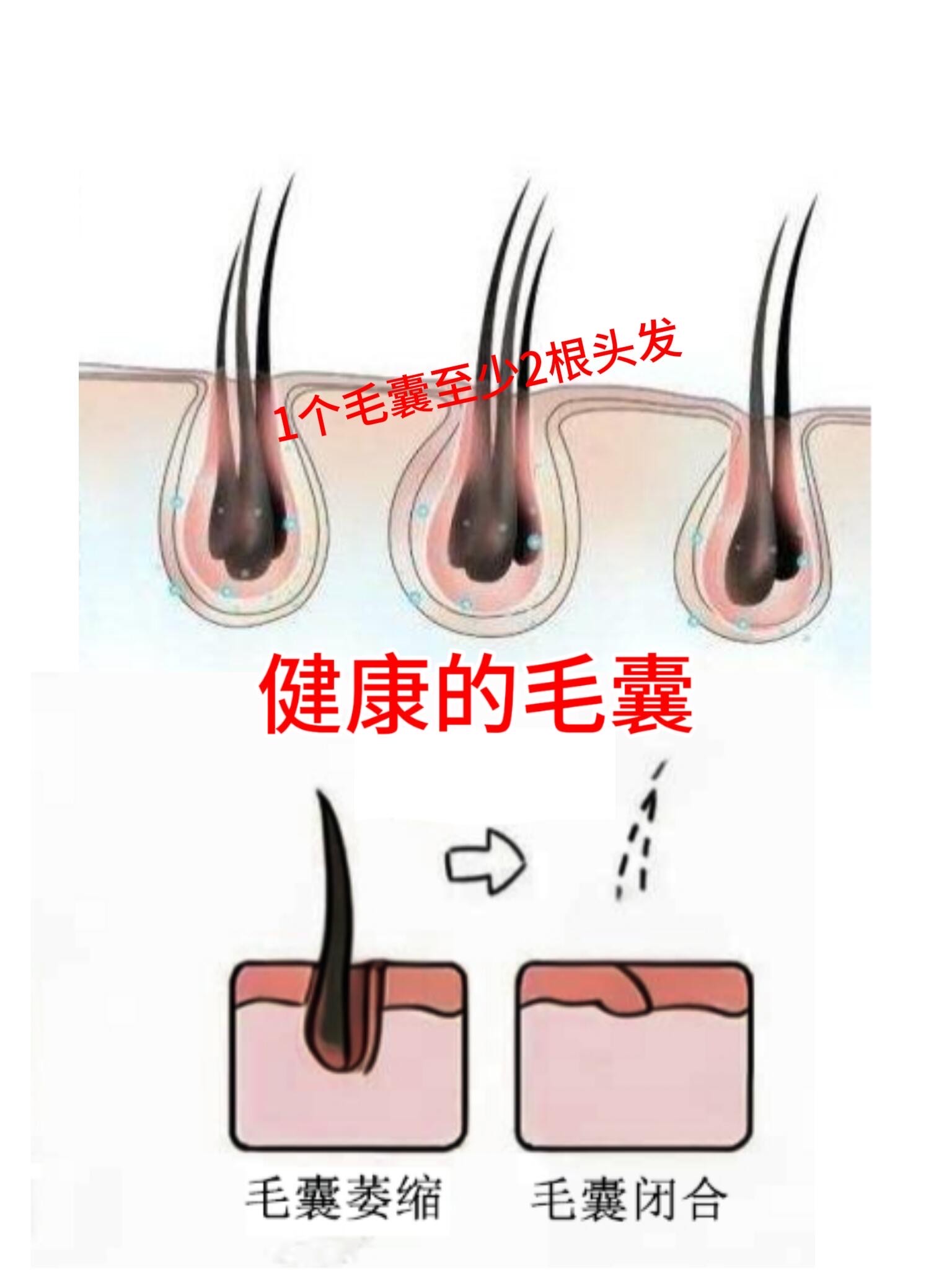 毛囊的样子 图片图片