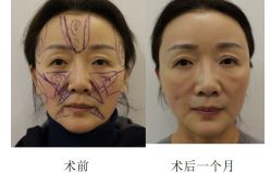 -丰联丽格医疗美容·联合丽格眼整形中心