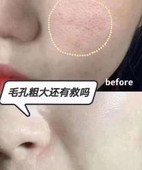 -美肤盾祛痘·问题肌头疗管理中心