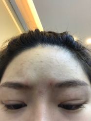 -More摩尔医美の注射线雕光电中心
