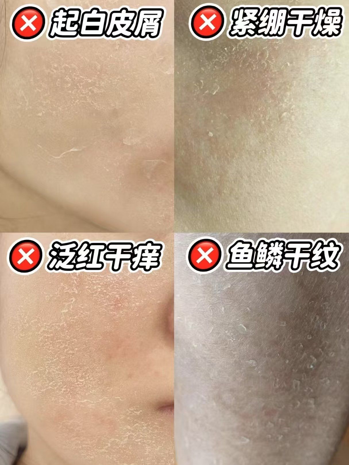 干皮的特征有这几点,你是干皮吗?