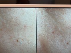 -苑苑vbeauty科技美容SPA