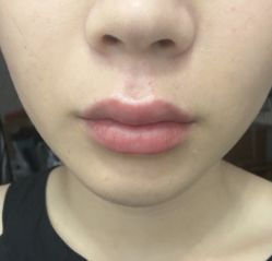 -伊丽莎白医疗美容