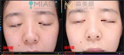 -韩国淼美颜皮肤管理官方直营店