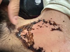 -北京市垂杨柳医院