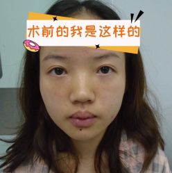 -素美医疗美容·西南眼鼻整形·修复基地