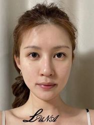 -LUNA皮相美·骨相美高级美感