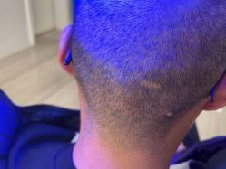 -雍禾植发全国连锁