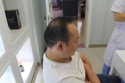 -大麦微针植发丨全国连锁