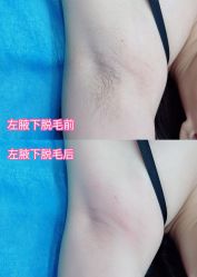 体验前-鑫元辰医疗美容整形