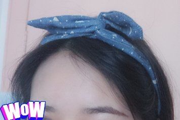 -大麦微针植发丨全国连锁