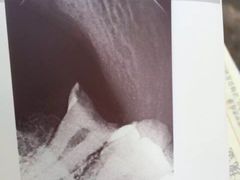 -上海市杨浦区牙病防治所