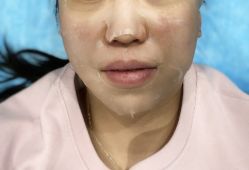 -澳尔颜选医疗美容
