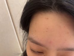 点击看大图 -广东韩妃整形外科医院