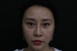 -深圳春天阳光医院·轮廓抗衰中心