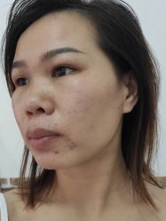 -深圳阳光医疗美容医院·旗舰店