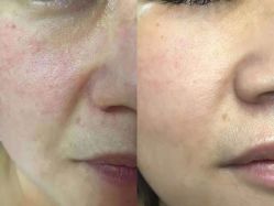 -苗方清颜痘肌研究所