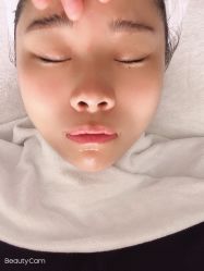 体验后-杭州整形医院·国际部