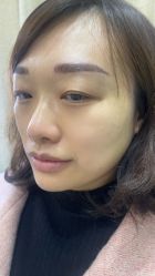 点击看大图 体验后-重庆联合丽格第五医疗美容医院