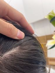 -熙朵美学植发连锁