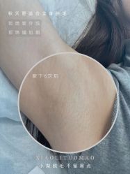 -小梨·OndaPro·专业脱毛连锁机构