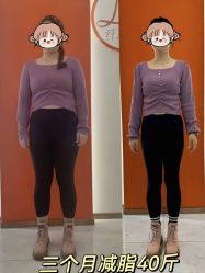 -Lily纤美·科技减脂中心