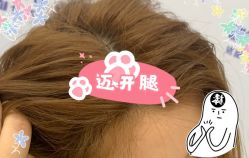 -大麦微针植发全国连锁