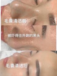 点击看大图 -玫莉蔻皮肤管理中心