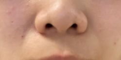-清疣美疣·痣·斑净肤中心