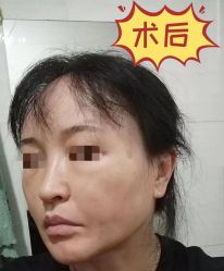 -素美医疗美容·西南眼鼻整形·修复基地