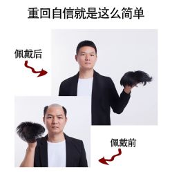 -发饰美男士增发补发假发定制店