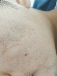 -蕾特恩专业祛痘·皮肤管理