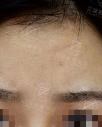 -正璞医疗美容·皮肤修复·微整注射