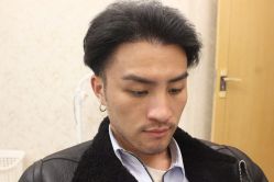 点击看大图 -大麦微针植发丨全国连锁