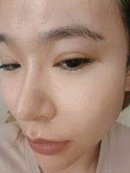 体验后-北京炫美医疗美容