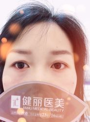 -南京健丽·去眼袋医疗美容机构