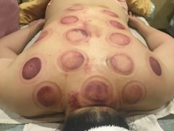 -源素美容养生会所